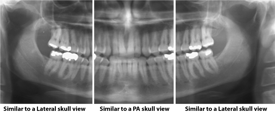 PPan_segmented